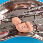 Faktor Risiko Keguguran Yang Perlu Diwaspadai