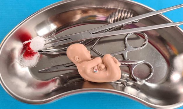 Faktor Risiko Keguguran Yang Perlu Diwaspadai