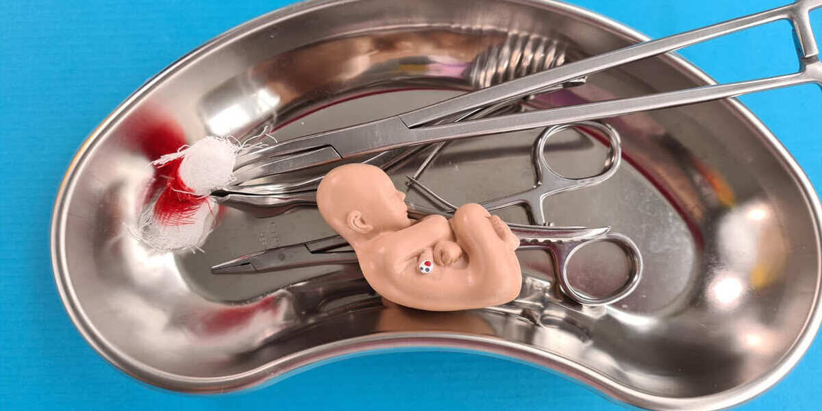 Faktor Risiko Keguguran Yang Perlu Diwaspadai